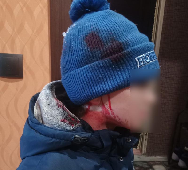 ������� ��������� ���� ����� � � ������ ������� � ������, ���� �� ������ �� ������� ������������ �������