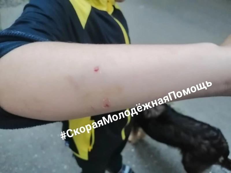 В сети сообщили о нападении собаки на ребенка в Сызрани